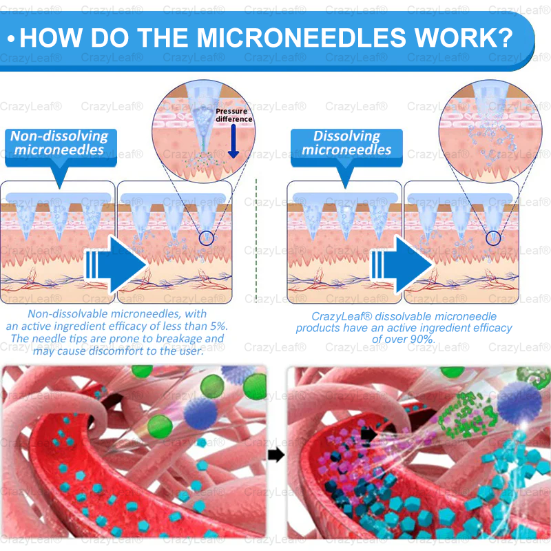 𝑪𝒓𝒂𝒛𝒚𝑳𝒆𝒂𝒇® 𝑺𝒌𝒊𝒏 𝑭𝒊𝒓𝒎𝒊𝒏𝒈 𝑷𝒂𝒕𝒄𝒉, 𝒆𝒇𝒇𝒆𝒄𝒕𝒊𝒗𝒆𝒍𝒚 𝒂𝒅𝒅𝒓𝒆𝒔𝒔𝒊𝒏𝒈 𝒔𝒌𝒊𝒏 𝒔𝒂𝒈𝒈𝒊𝒏𝒈 𝒂𝒇𝒕𝒆𝒓 𝒓𝒂𝒑𝒊𝒅 𝒘𝒆𝒊𝒈𝒉𝒕 𝒍𝒐𝒔𝒔. 𝑶𝒓𝒅𝒆𝒓 𝒏𝒐𝒘 𝒂𝒏𝒅 𝒆𝒏𝒋𝒐𝒚 𝒂 50% 𝒅𝒊𝒔𝒄𝒐𝒖𝒏𝒕!