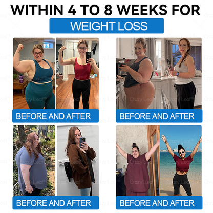 𝑪𝒓𝒂𝒛𝒚𝑳𝒆𝒂𝒇® 𝑺𝒌𝒊𝒏 𝑭𝒊𝒓𝒎𝒊𝒏𝒈 𝑷𝒂𝒕𝒄𝒉, 𝒆𝒇𝒇𝒆𝒄𝒕𝒊𝒗𝒆𝒍𝒚 𝒂𝒅𝒅𝒓𝒆𝒔𝒔𝒊𝒏𝒈 𝒔𝒌𝒊𝒏 𝒔𝒂𝒈𝒈𝒊𝒏𝒈 𝒂𝒇𝒕𝒆𝒓 𝒓𝒂𝒑𝒊𝒅 𝒘𝒆𝒊𝒈𝒉𝒕 𝒍𝒐𝒔𝒔. 𝑶𝒓𝒅𝒆𝒓 𝒏𝒐𝒘 𝒂𝒏𝒅 𝒆𝒏𝒋𝒐𝒚 𝒂 50% 𝒅𝒊𝒔𝒄𝒐𝒖𝒏𝒕!