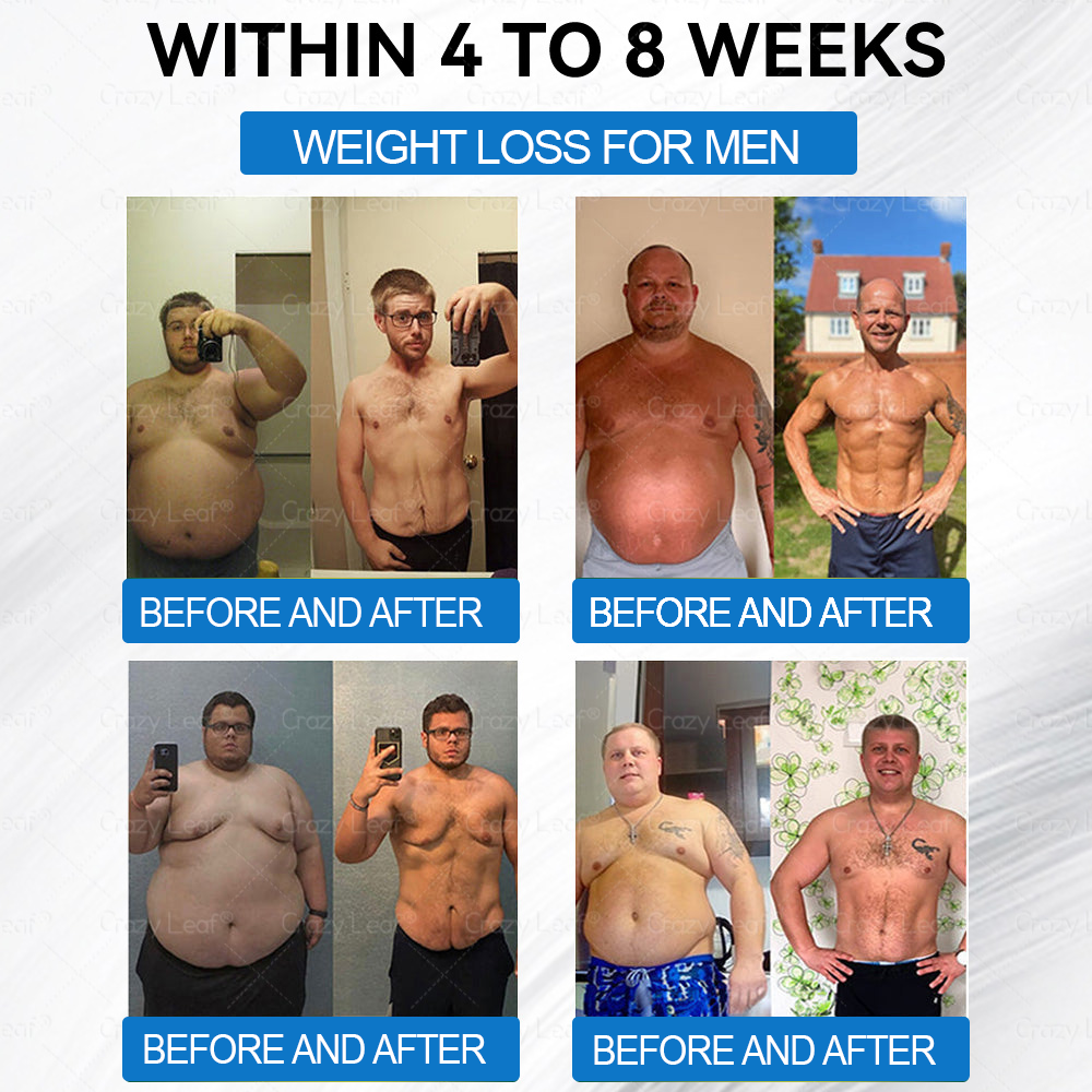 𝑪𝒓𝒂𝒛𝒚𝑳𝒆𝒂𝒇® 𝑺𝒌𝒊𝒏 𝑭𝒊𝒓𝒎𝒊𝒏𝒈 𝑷𝒂𝒕𝒄𝒉, 𝒆𝒇𝒇𝒆𝒄𝒕𝒊𝒗𝒆𝒍𝒚 𝒂𝒅𝒅𝒓𝒆𝒔𝒔𝒊𝒏𝒈 𝒔𝒌𝒊𝒏 𝒔𝒂𝒈𝒈𝒊𝒏𝒈 𝒂𝒇𝒕𝒆𝒓 𝒓𝒂𝒑𝒊𝒅 𝒘𝒆𝒊𝒈𝒉𝒕 𝒍𝒐𝒔𝒔. 𝑶𝒓𝒅𝒆𝒓 𝒏𝒐𝒘 𝒂𝒏𝒅 𝒆𝒏𝒋𝒐𝒚 𝒂 50% 𝒅𝒊𝒔𝒄𝒐𝒖𝒏𝒕!