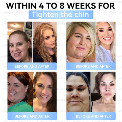 🏥FDA Store |𝐵uil𝗱𝐿ea𝐟® 𝑮𝐋𝑃-1 Slim & Firm 𝑁ano 𝑀icroneedle 𝑃atch with Collagen,Turmeric&Matrixyl 3000 丨Obesity,Cardiovascular Diseas, Diabetes, Sleep Apnea, Joint Problems and More