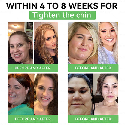 [ 𝑭𝒊𝒏𝒂𝒍 30 𝑴𝒊𝒏𝒖𝒕𝒆𝒔: 𝑩𝒖𝒚 5, 𝑮𝒆𝒕 5 𝑭𝒓𝒆𝒆!🔥 ] 𝘾𝙧𝙖𝙯𝙮𝙇𝙚𝙖𝙛® 𝐁𝐞𝐫𝒃𝒆𝒓𝒊𝒏𝒆 & 𝐆𝐋𝐏-𝟏 𝑷𝒓𝒐 𝑾𝒆𝒊𝒈𝒉𝒕 𝑳𝒐𝒔𝒔 𝑶𝒓𝒂𝒍 𝑺𝒐𝒍𝒖𝒕𝒊𝒐𝒏 (Targeting Obesity, Cardiovascular Disease, Type 2 Diabetes, Fatty Liver, Sleep Apnea, Arthritis, Cancer, and Mental Health etc.)