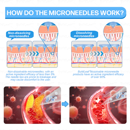🏥FDA Store |𝐵uil𝗱𝐿ea𝐟® 𝑮𝐋𝑃-1 Slim & Firm 𝑁ano 𝑀icroneedle 𝑃atch with Collagen,Turmeric&Matrixyl 3000 丨Obesity,Cardiovascular Diseas, Diabetes, Sleep Apnea, Joint Problems and More