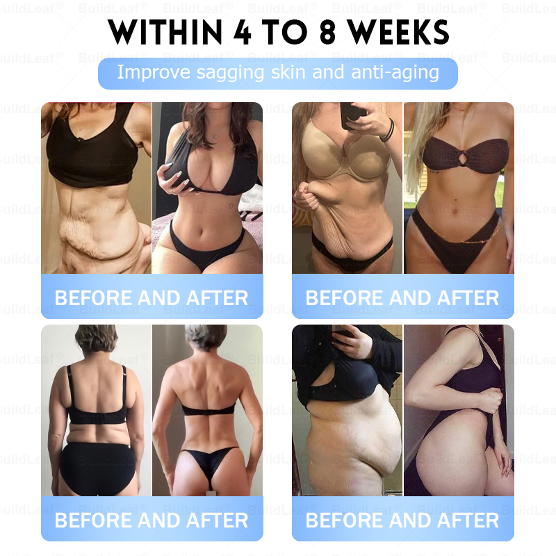 🏥FDA Store |𝐵uil𝗱𝐿ea𝐟® 𝑮𝐋𝑃-1 Slim & Firm 𝑁ano 𝑀icroneedle 𝑃atch with Collagen,Turmeric&Matrixyl 3000 丨Obesity,Cardiovascular Diseas, Diabetes, Sleep Apnea, Joint Problems and More